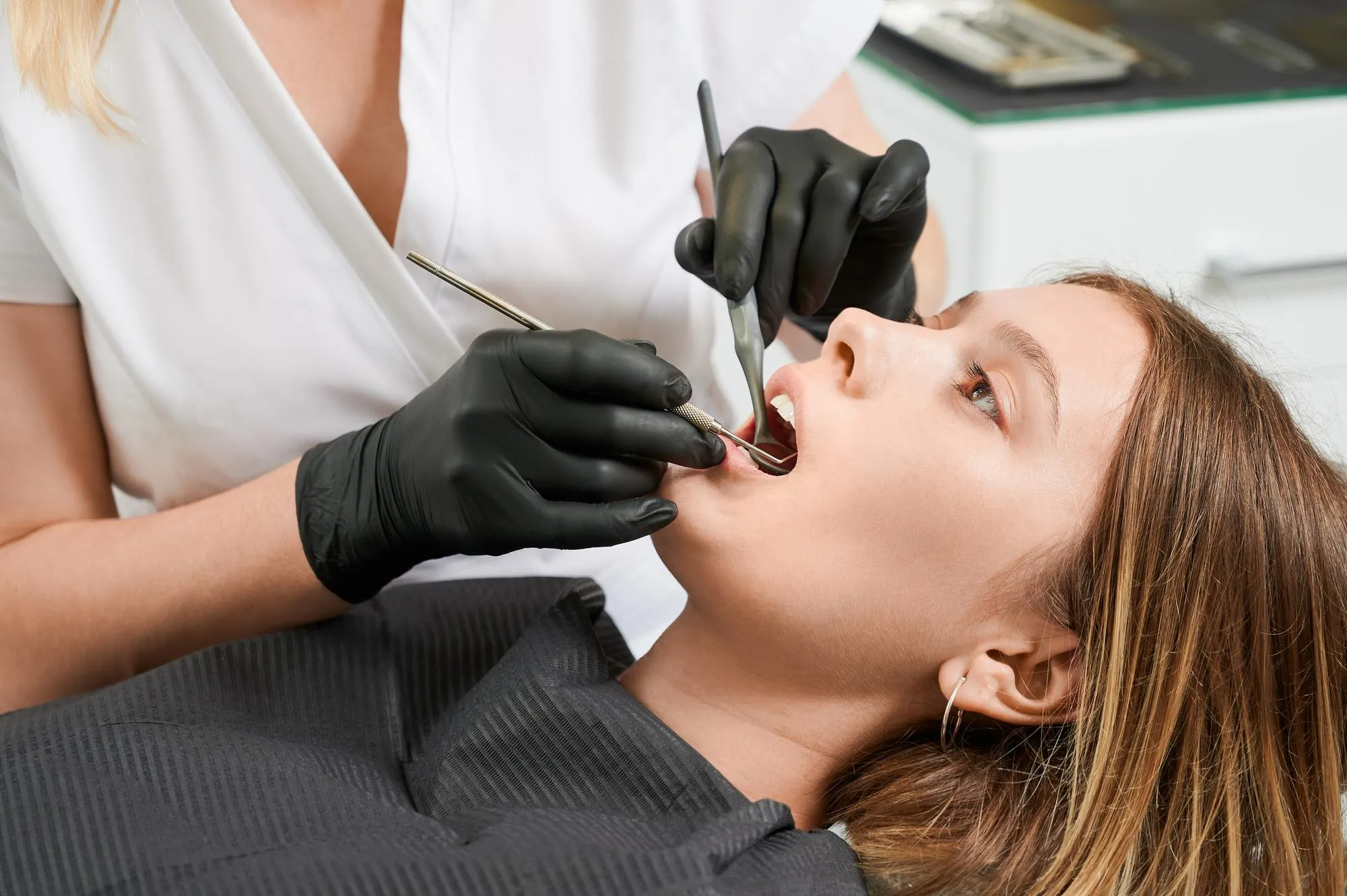 caries-clinica-ronald-Blog