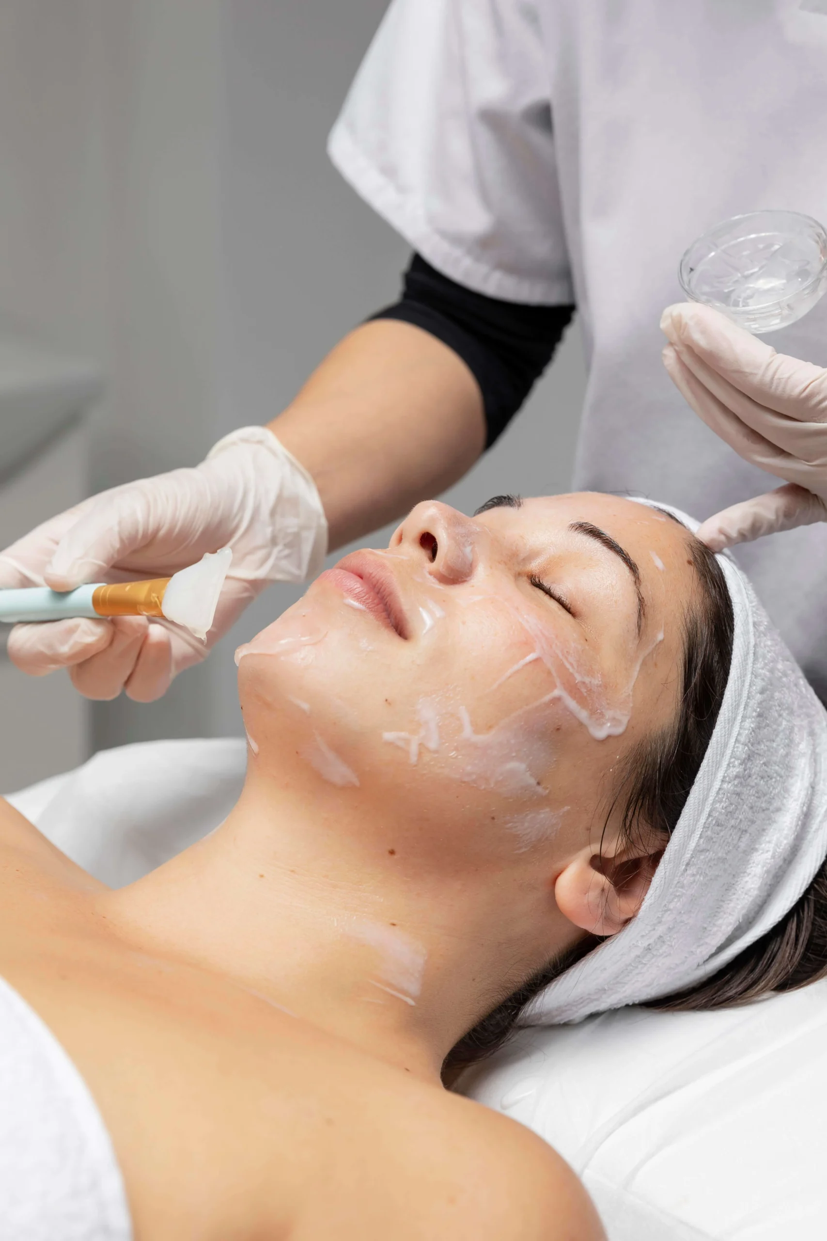 Aplicación de peeling químico facial
